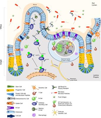 The intestine: A highly dynamic microenvironment for IgA plasma cells